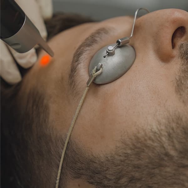 Picosure-laser-forehead-eye-protection