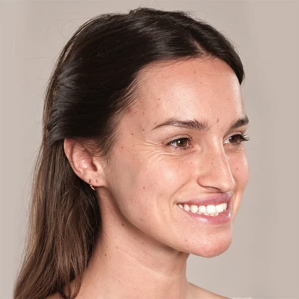 texoane-treatment-smile