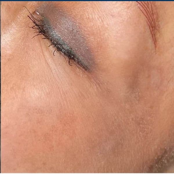 3DMIRACL-clear-after